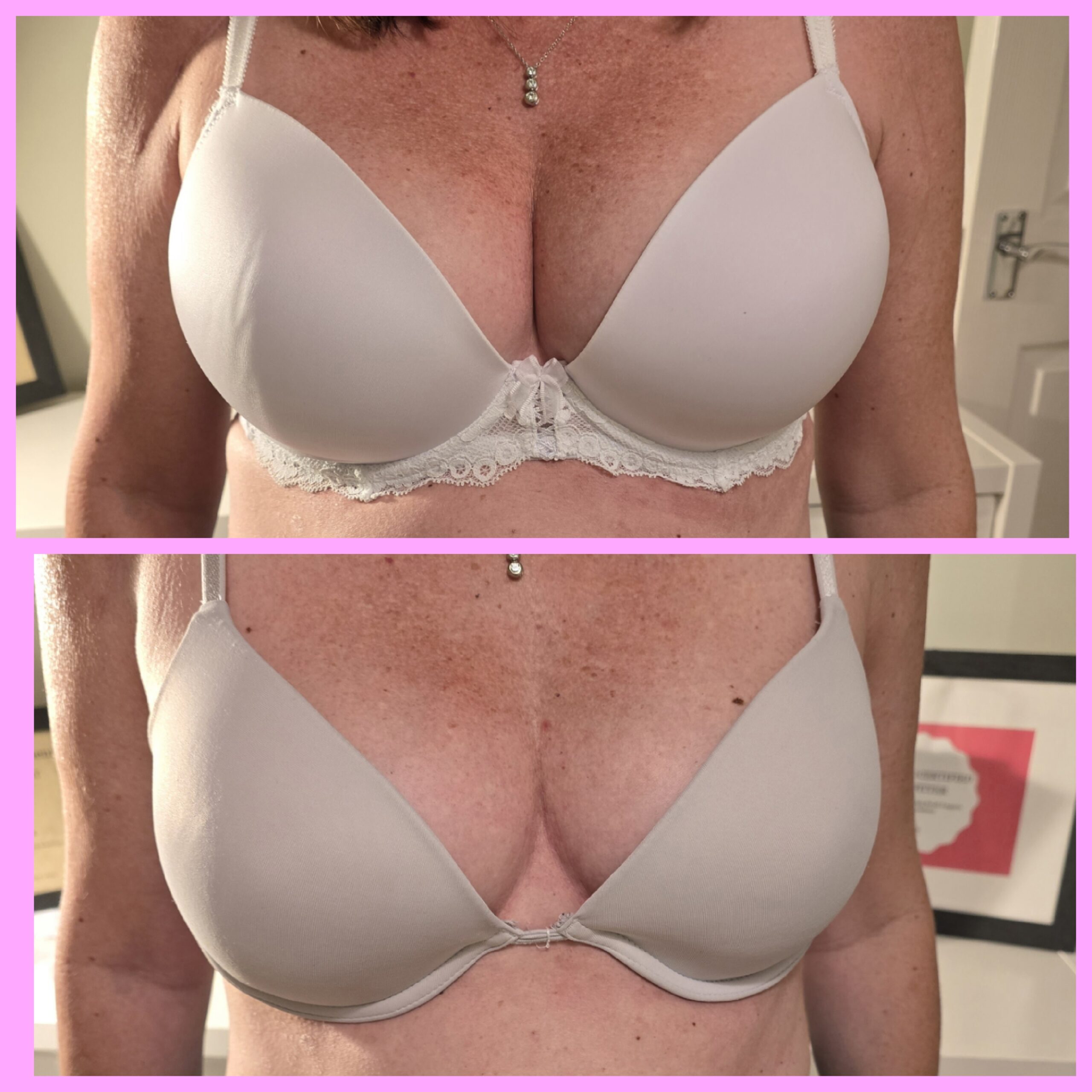 Bra examples before and after 2